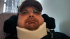 A post-op Junior Sisk, shortly after his spinal cord surgery